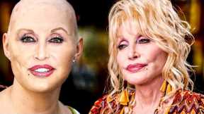 Dolly Parton Reveals Her Real Hair (Why She Wears Wigs)